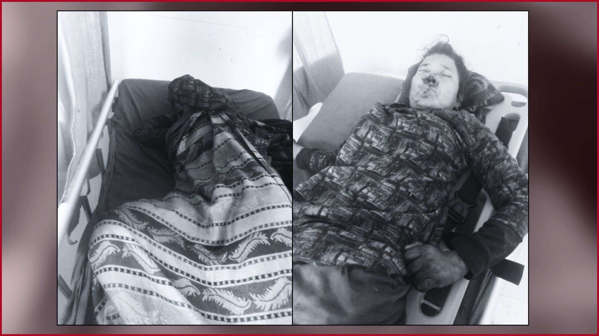 देउरानीले बाउसो प्रहारबाट घाइते जेठानीको मृत्यु