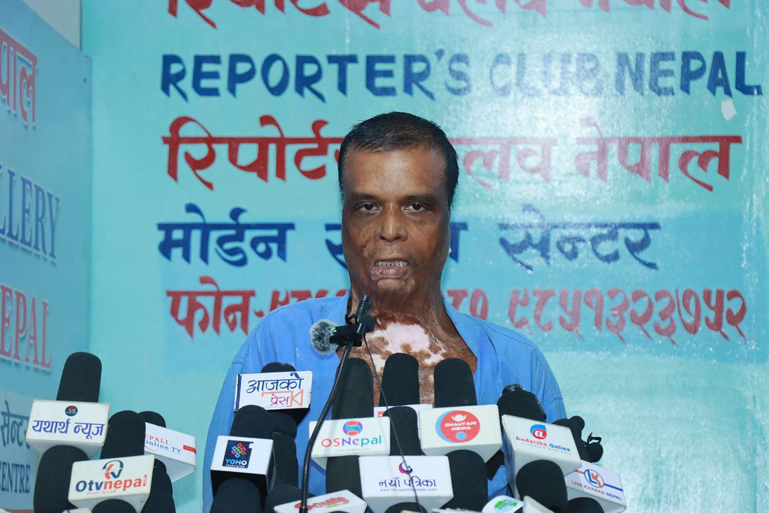 आलमले सफाइ पाए, बम लागेका गौरीशंकर पीडा सुनाउन काठमाडौं आए