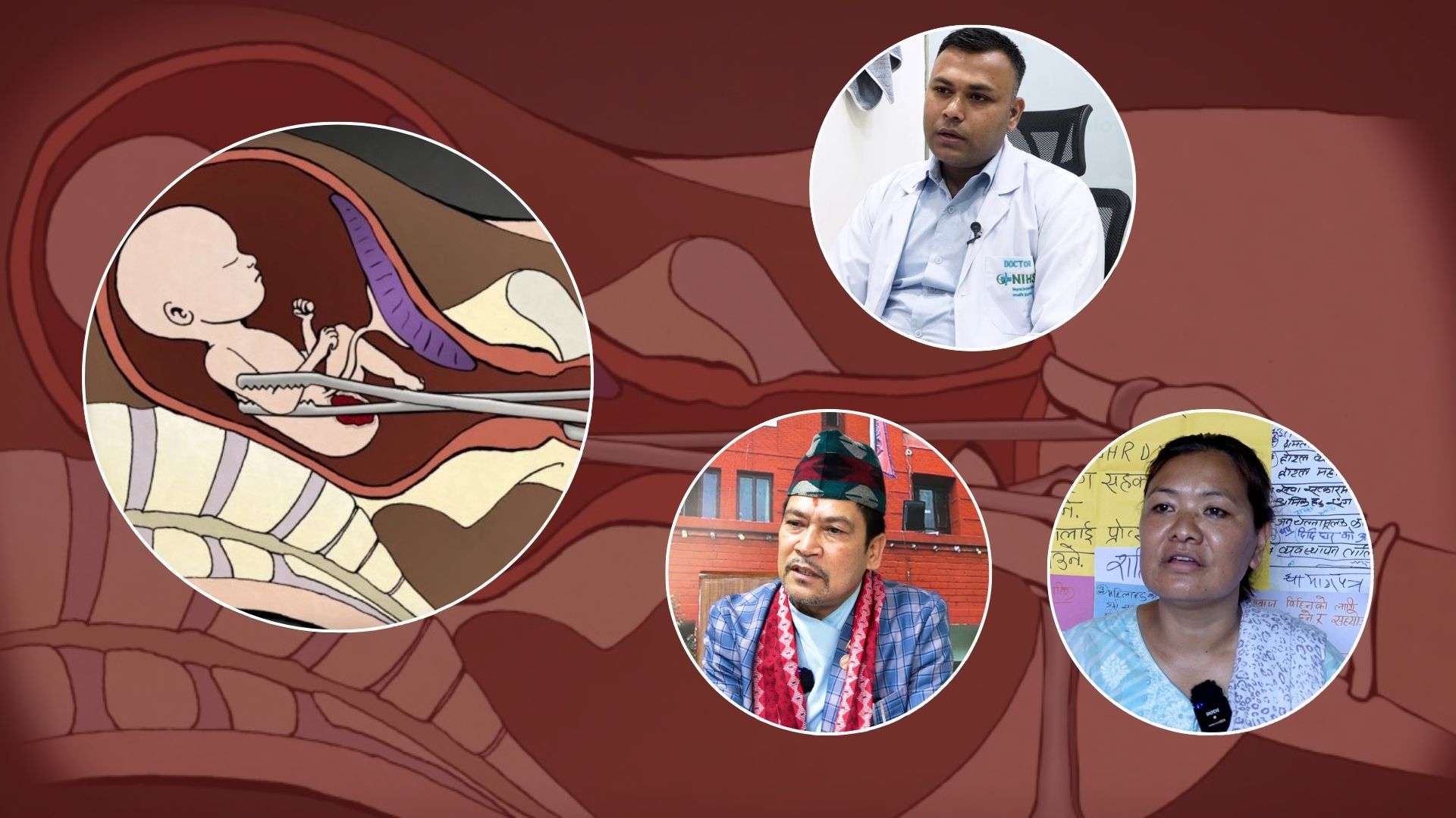 नेपालमा गर्भपतन अधिकार : महिलाको अधिकारमा समाज नै बाधक